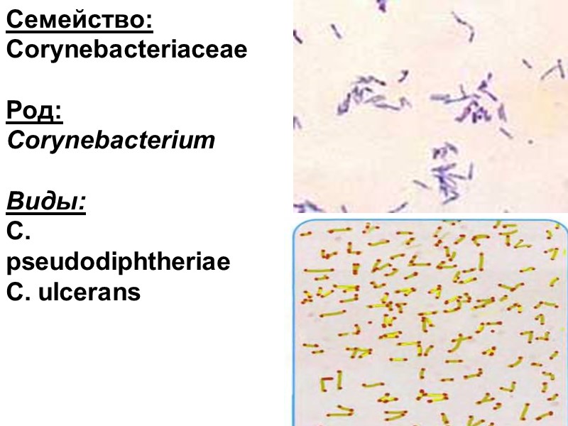 Семейство: Corynebacteriaceae  Род:  Corynebacterium  Виды: С. рseudodiphtheriae С. ulcerans